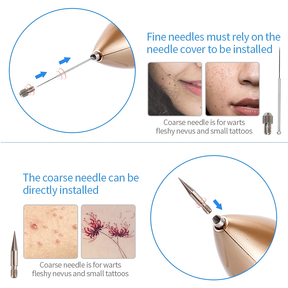 plasma pen laser tattoo mol verwijdering machine lcd oplaadbare gezichtsverzorging skin tag verwijdering sproet wrat donkere vlek remover 2025 - $25.99 –P12
