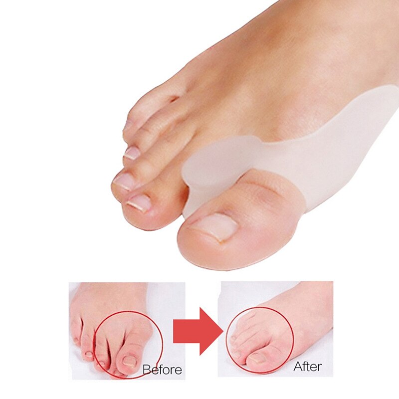 1 paio di dita dei piedi in silicone separatore del piede alluce valgo correzione bone ectropion dita dei piedi dispositivo esterno strumento di cura del piede gel alluce alluce separatore spreader del 2025 a $13.99 –P11