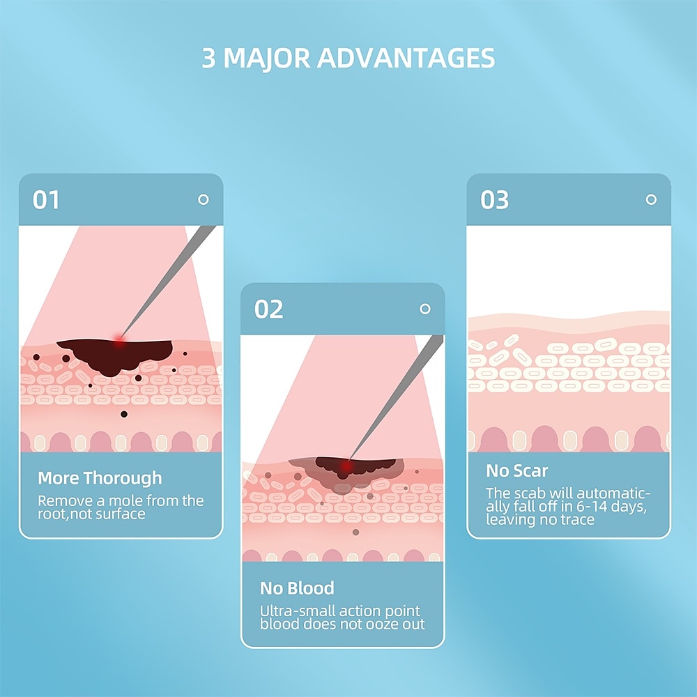 Electric LCD Display Portable Freckle Warts Dot Mole Dark Spot Freckle Removal Eraser Pen Salon Beauty Tool Valentine's Day Gift 2026 - $22.99 –P16