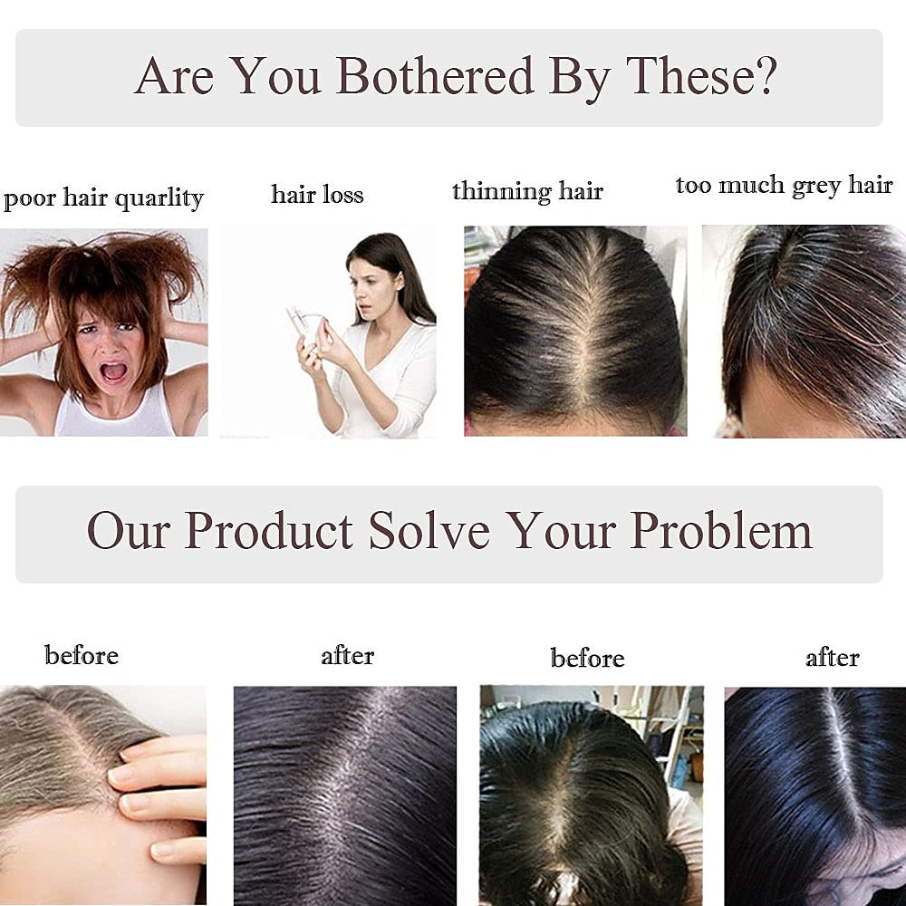 Choices 120% Density Silk Base Top Hairpiece 100% Human Hair Extensions Clip In On Hair Topper For Women Hand-made Top Hair Piece Middle Part With Thinning Hair Loss Hair #4 Medium Brown 6'' 27g 2025 - $126.98 –P6