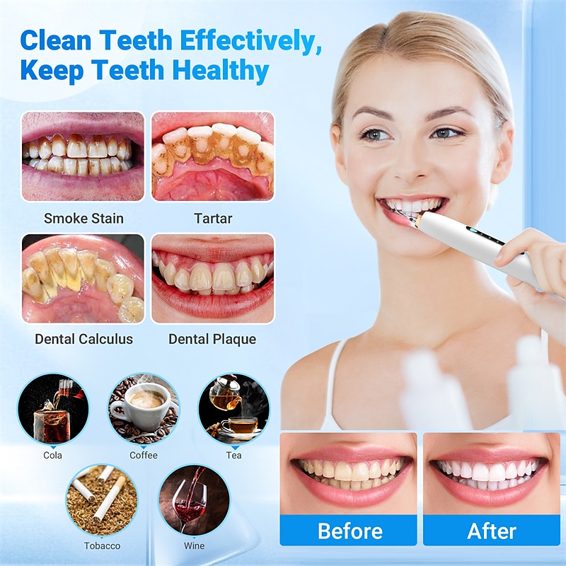 elektrische sonic tandheelkundige monddouche scaler tanden bleken draagbare ultrasone tandsteen tandsteen remover tanden reinigen tool 2025 - $28.99 –P8