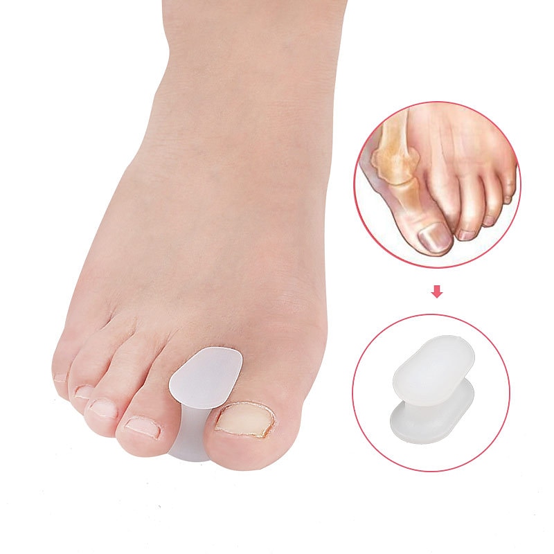 1PC Gel Toe Separators for Overlapping Toes Bunions Big Toe Alignment Corrector and Spacer (White) 2025 - $7.49 –P1