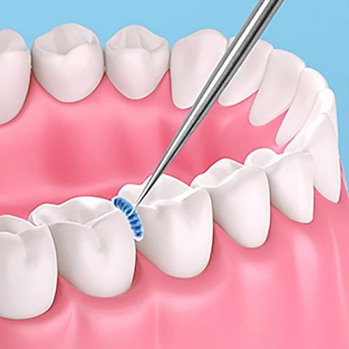Juego de bolsillo para palillos de dientes de acero inoxidable portátil de 7 piezas, kit de limpieza de palillos de dientes de metal reutilizable con soporte para picnic al aire libre, camping, viajes 2025 - $7.99 -P13
