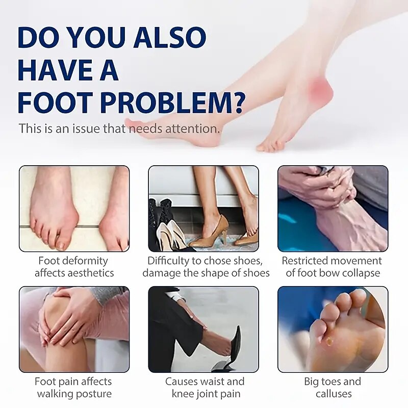 Bunion Cushion Protection (Suitable Night And Home Use And Replace Them Regularly) Toe Corrector Relieving Pressure For Pain Relief 2025 - $13.99 –P6