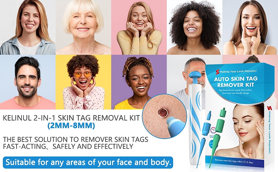 2 IN 1 Auto Micro Skin Tag Remover Device Standard And Micro Skin Tag Removal Kit Adult Mole Wart Remover Original Face Care Beauty Tool 2024 - $25.99 –P1