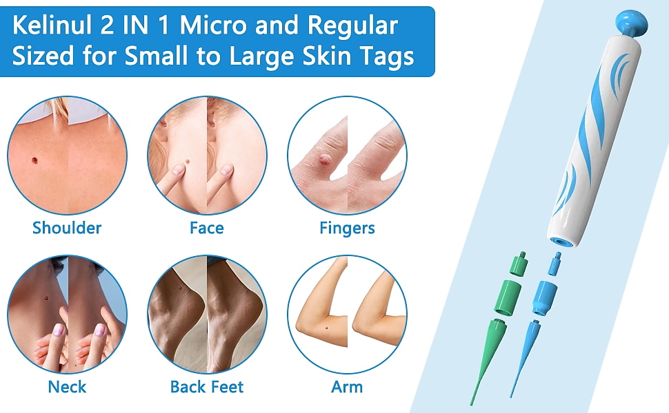 2 IN 1 Auto Micro Skin Tag Remover Device Standard And Micro Skin Tag Removal Kit Adult Mole Wart Remover Original Face Care Beauty Tool 2024 - $25.99 –P2