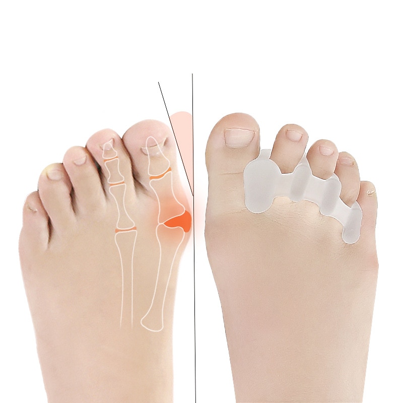 Silicone Thong Sandal Toe Flip Big Toe Spreader Cushion Bunion Pads Hard Silicone Toe Finger Separator 3 Hole Hallux Valgus Orthopedic Spacers Bunion Overlapping Hammer Foot Corrector 2025 - $9.99 –P2