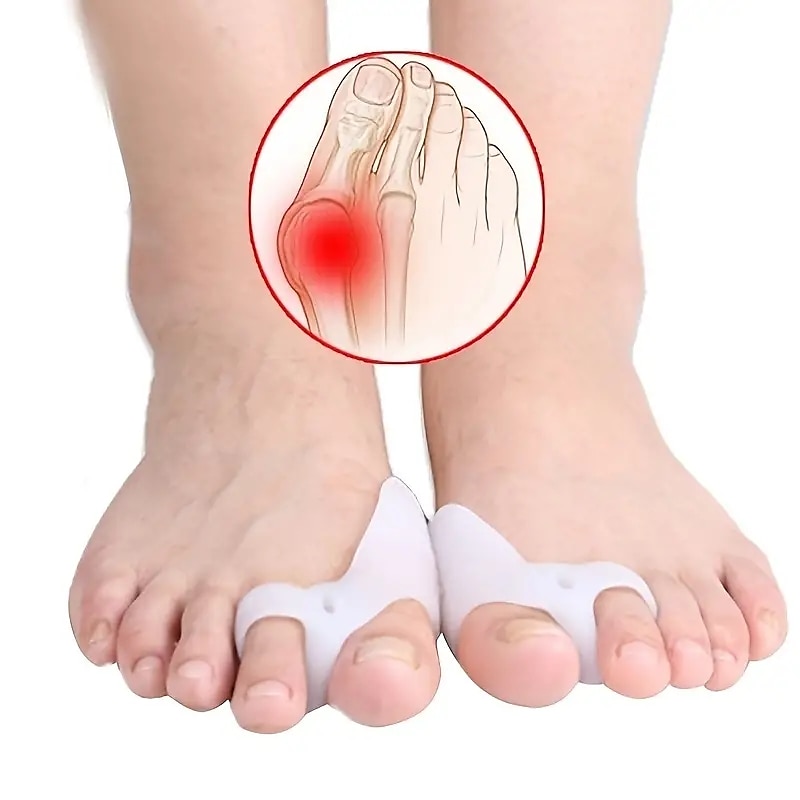 1 ζεύγος σιλικόνης διορθωτής δακτύλων hallux valgus buffer διαχωριστικό δακτύλων για άνδρες και γυναίκες 2025 - $13.99 –P1