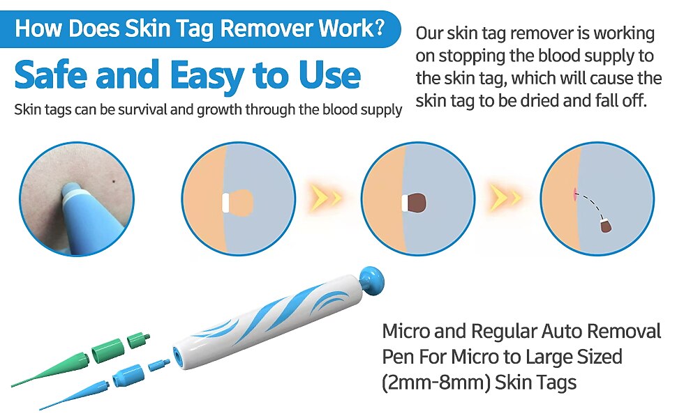 2 IN 1 Auto Micro Skin Tag Remover Device Standard And Micro Skin Tag Removal Kit Adult Mole Wart Remover Original Face Care Beauty Tool 2024 - $25.99 –P5