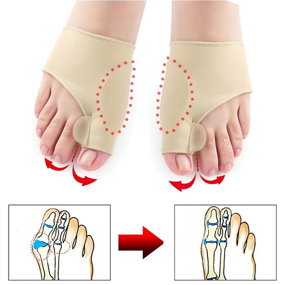 2db/pár lábujjleválasztó hallux valgus bunion korrektor kalapácsos lábujjkiegyenesítő lábfájdalomcsillapító ortopéd pedikűr eszközök lábápolás 2025 - $9.99 -P6