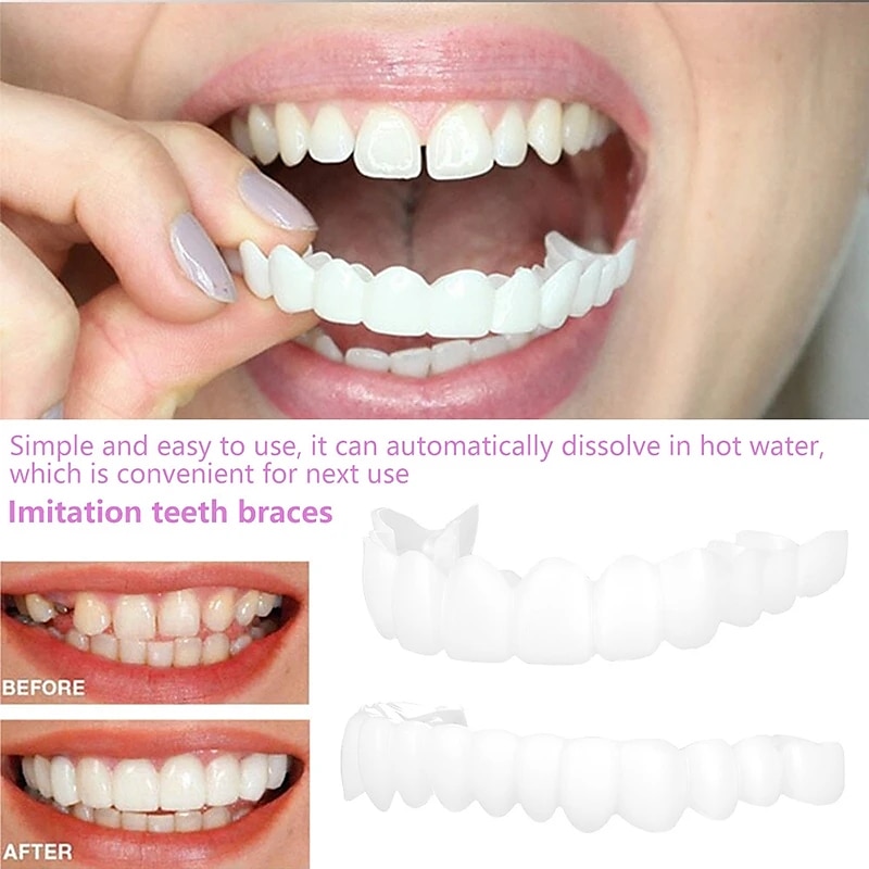 1 Packung Silikon-Zahnaufhellung, Zahnspangen, Simulationsprothese, obere Zähne, untere Zähne, Set mit Box, perfektes Lächeln 2025 - $9.49 –P2