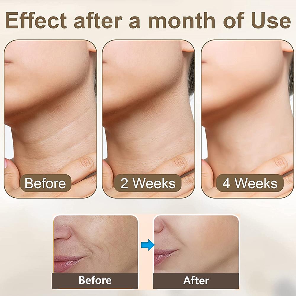 HY48 Neck Anti Wrinkle Face Lifting Beauty Device Led Photon Therapy Skin Tighten Reduce Double Chin Remove Neck Lines Valentine's Day Gift 2026 - $27.99 –P4