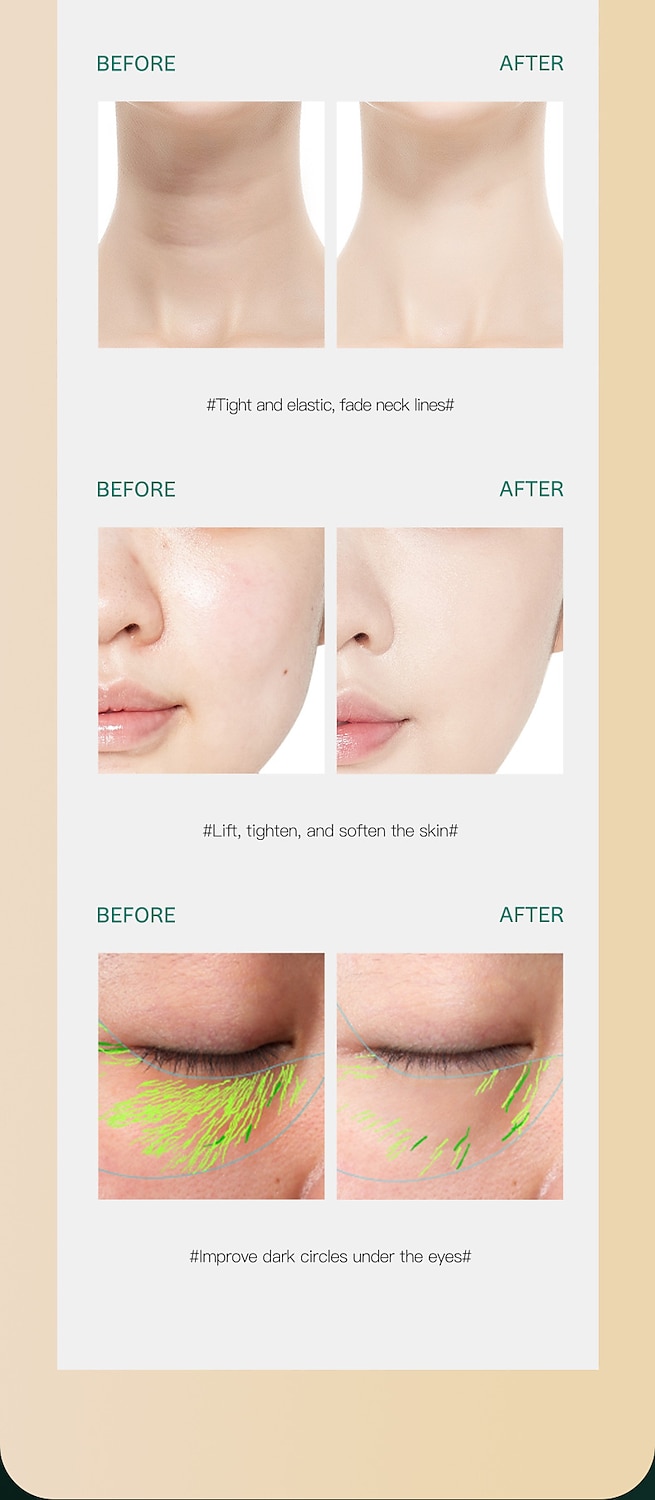 3 in 1 Face Neck Massager ION LED Photon Therapy Facial Lifting Beauty Devices Remove Double Chin Anti Wrinkle Skin Care Tools 2025 - $17.99 –P14