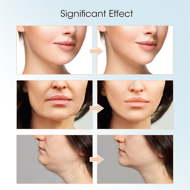 New EMS Face Lifting Machine Double Chin Remover Face Slimmer V - Face Lift Skin Tightening Device Facial Vibration Massagers 2025 - $35.99 –P9