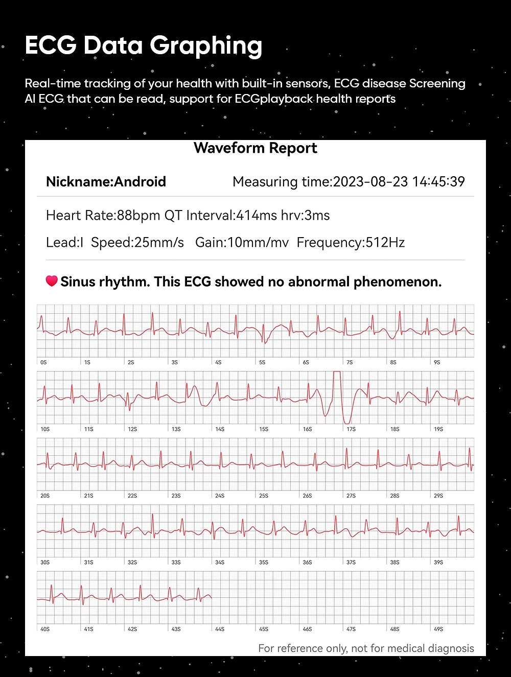 2025年 iMosi MT200 スマートウォッチ 1.43 インチ スマート·ウォッチ ブルートゥース ECG + PPG 温度監視 歩数計 と互換性があります Android iOS 女性 男性 長時間スタンバイ ハンドフリーコール 防水 IP 67 48mmウォッチケース  コレクション – $68.99 –P6