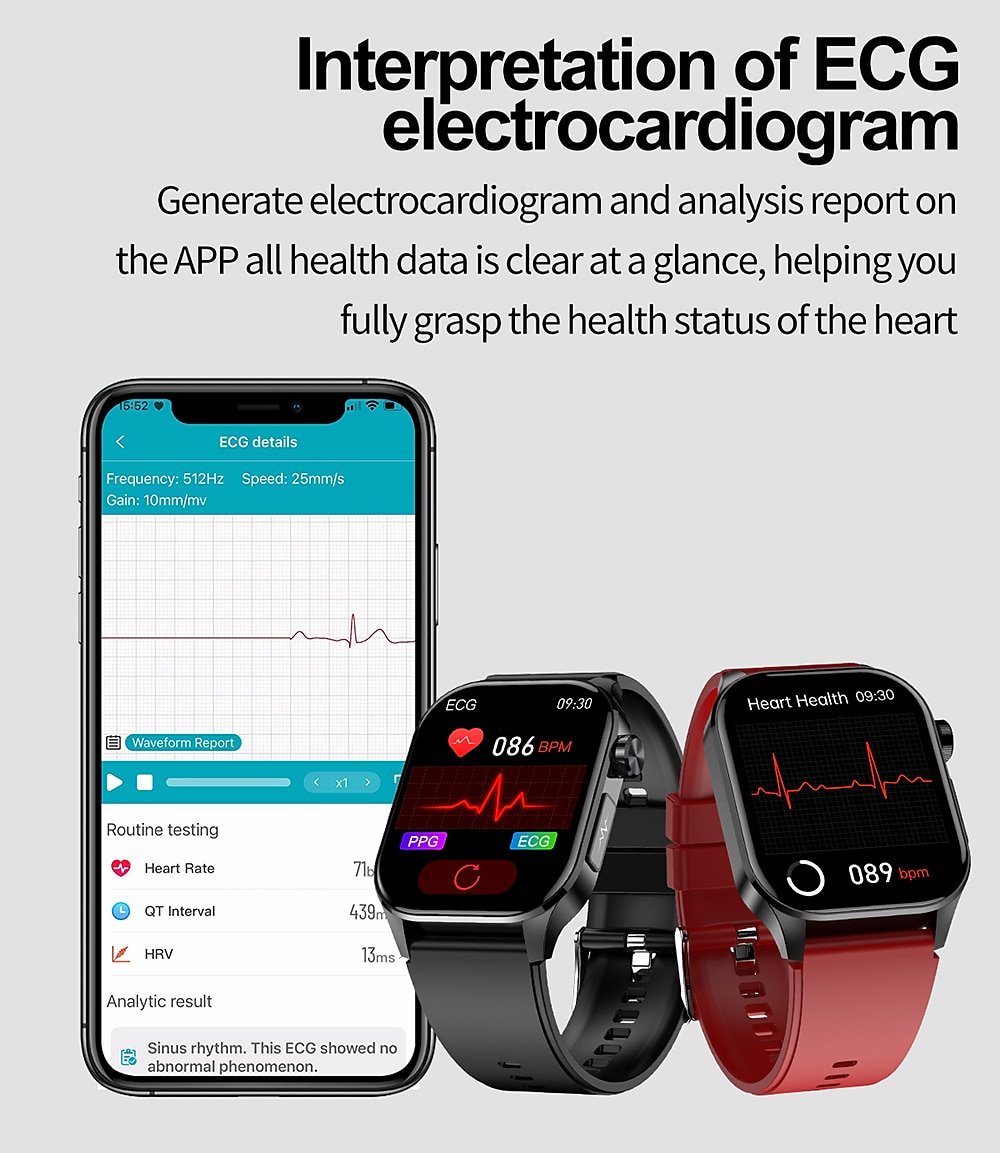 iMosi et580 Smart Watch 2.04 inch Smartwatch Fitness Running Watch Bluetooth ECG+PPG Pedometer Call Reminder Compatible with Android iOS Women Men Long Standby Waterproof Media Control IP68 38mm 2025 - $76.99 –P5