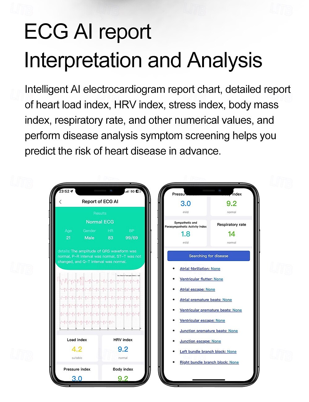 2025年 iMosi ET381 スマートウォッチ 1.43 インチ スマート·ウォッチ ブルートゥース ECG + PPG 温度監視 歩数計 と互換性があります Android iOS 女性 男性 ハンドフリーコール 防水 メディアコントロール IP 67 46mmの時計ケース  コレクション – $79.79 –P5