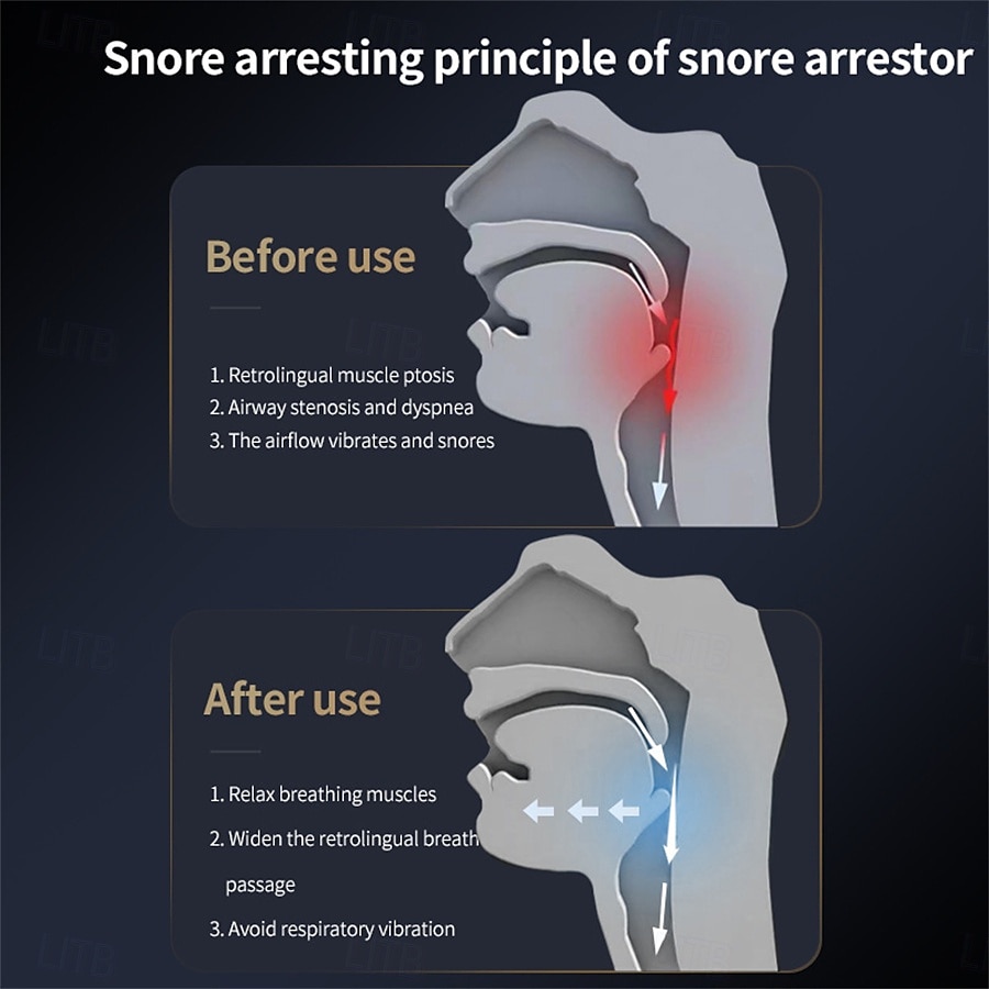 Anti-snoring Device Double Vortex Air anti Sleep Snoring Artifact Snoring Breathing Corrector for Snoring 2025 - $20.99 –P3
