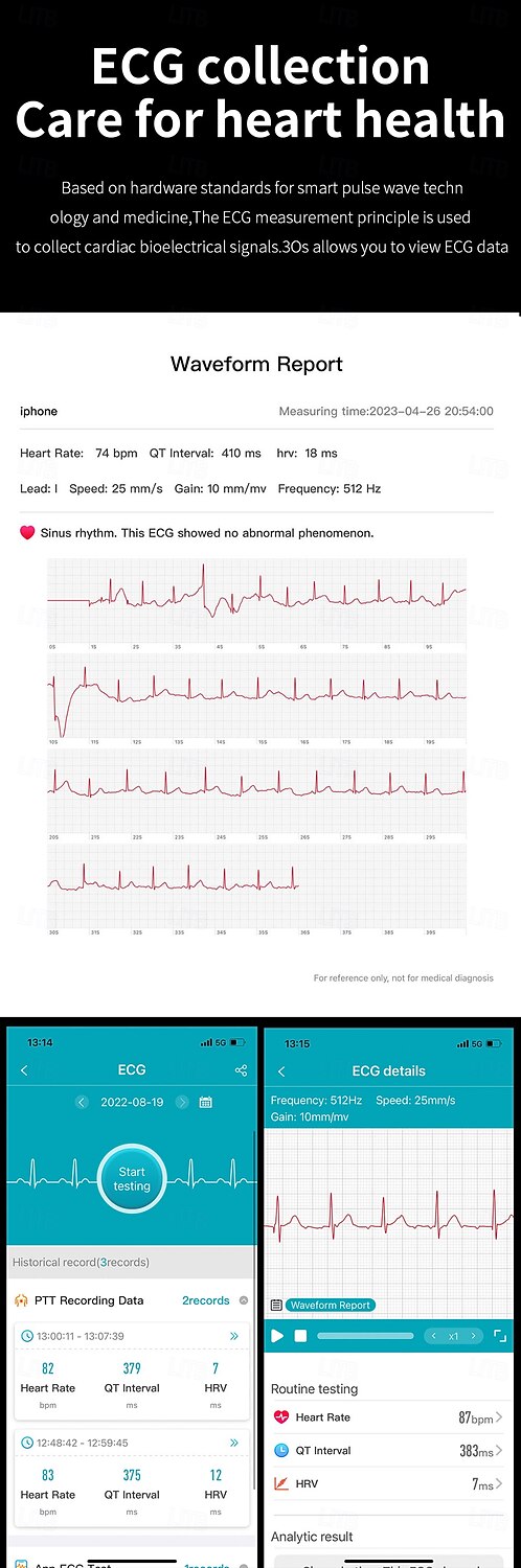 2025年 iMosi ET440 スマートウォッチ 1.39 インチ スマート·ウォッチ ブルートゥース ECG + PPG 温度監視 歩数計 と互換性があります Android iOS 女性 男性 ハンドフリーコール 防水 メディアコントロール IP 67 46mmの時計ケース  コレクション – $73.99 –P5