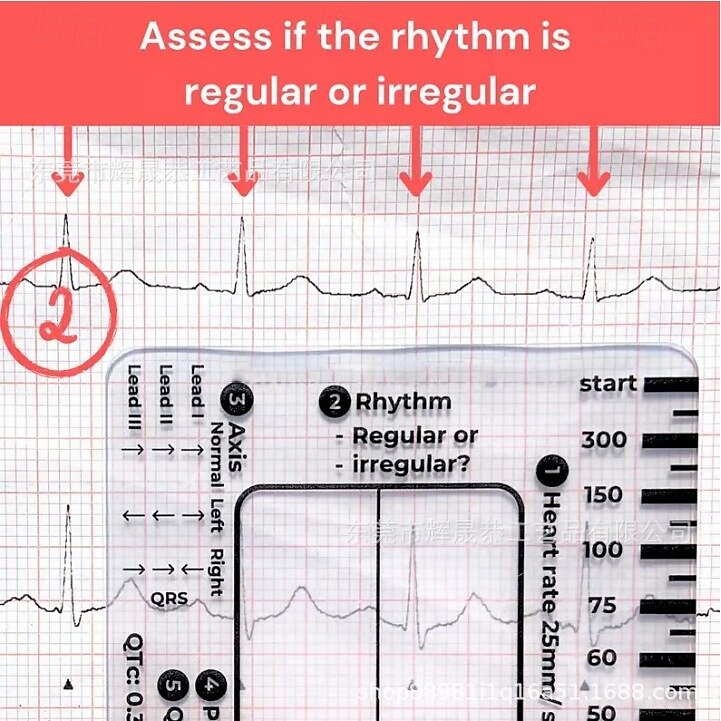 ECG 7 Step Ruler, ECG Ruler Plastic Ruler Measuring Tool, ECG 7 Step Ruler for ECG/EKG Interpretation, Transparent EKG Calipers Measuring Tool, Follow a 7 Step Plan 2025 - $6.99 –P3