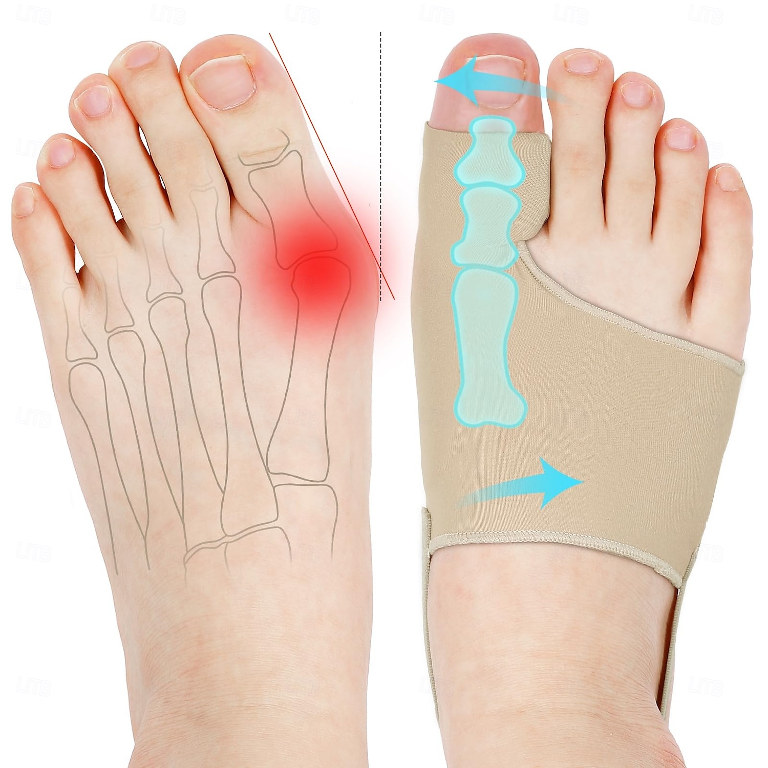 Lot de 2 correcteurs d'oignon pour femmes et hommes, chaussettes pour oignons, correcteur d'orteils, confortables, respirants pour un soutien de jour/nuit, soulagement de la douleur de l'hallux de 2025 ? $9.99 –P1