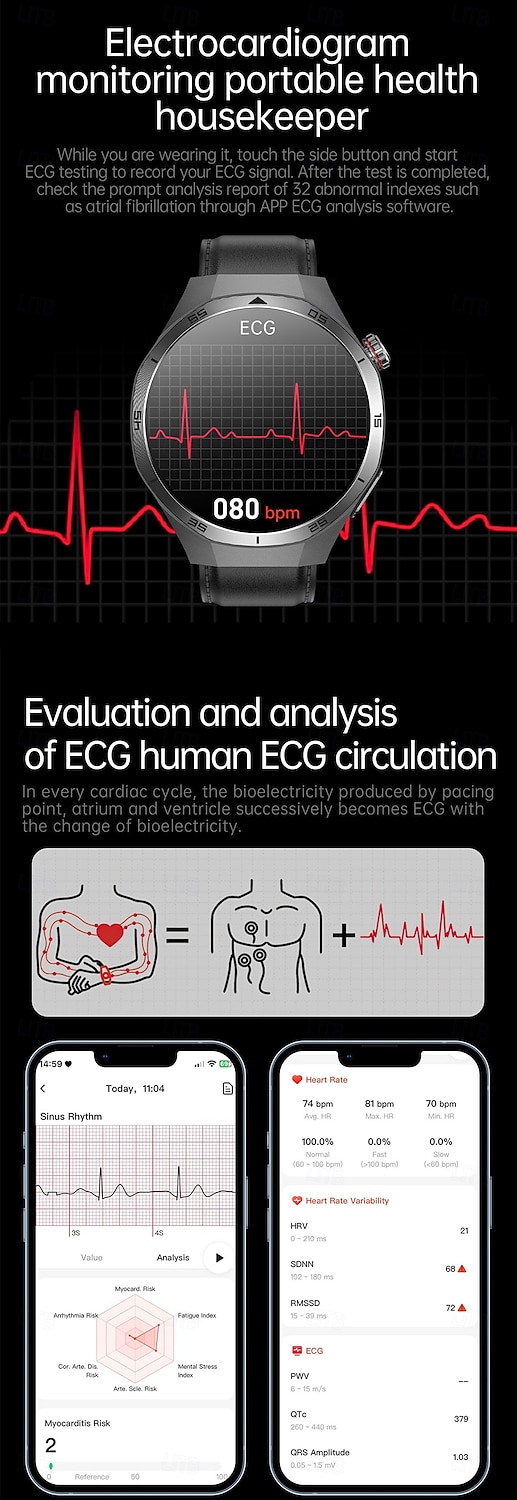 iMosi ET456 Smart Watch 1.56 inch Smartwatch Fitness Running Watch Bluetooth ECG+PPG Temperature Monitoring Pedometer Compatible with Android iOS Women Men Hands-Free Calls Waterproof Media Control 2025 - $63.99 –P5