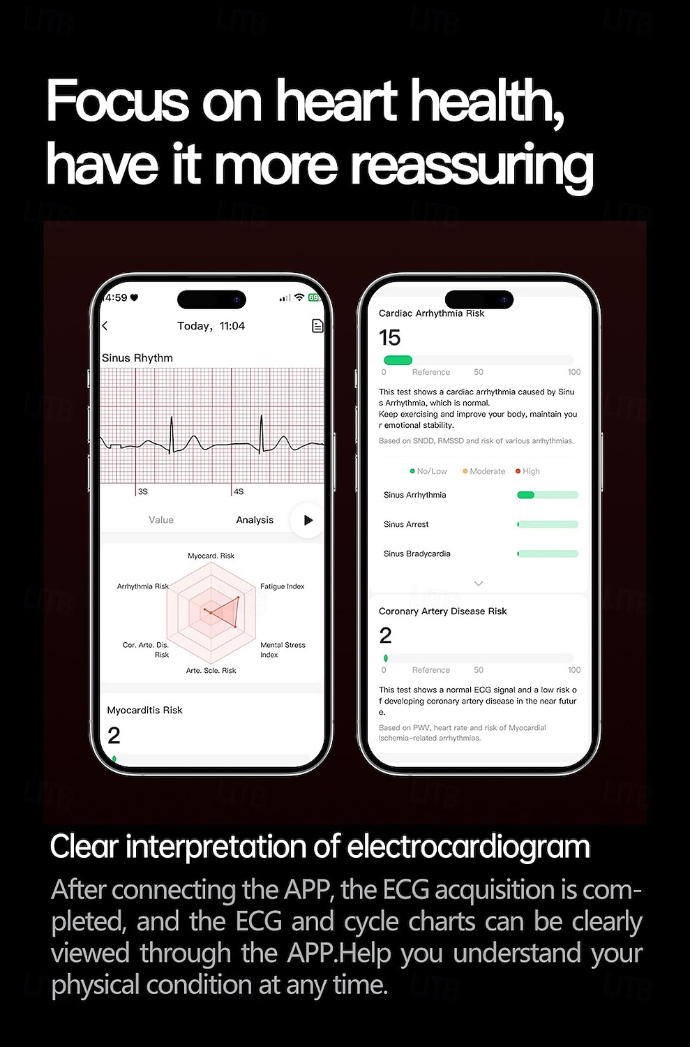 2025年 iMosi ET475 スマートウォッチ 1.73 インチ スマート·ウォッチ ブルートゥース ECG + PPG 温度監視 歩数計 と互換性があります Android iOS 女性 男性 長時間スタンバイ ハンドフリーコール 防水 IP68 51mmウォッチケース  コレクション – $82.99 –P5