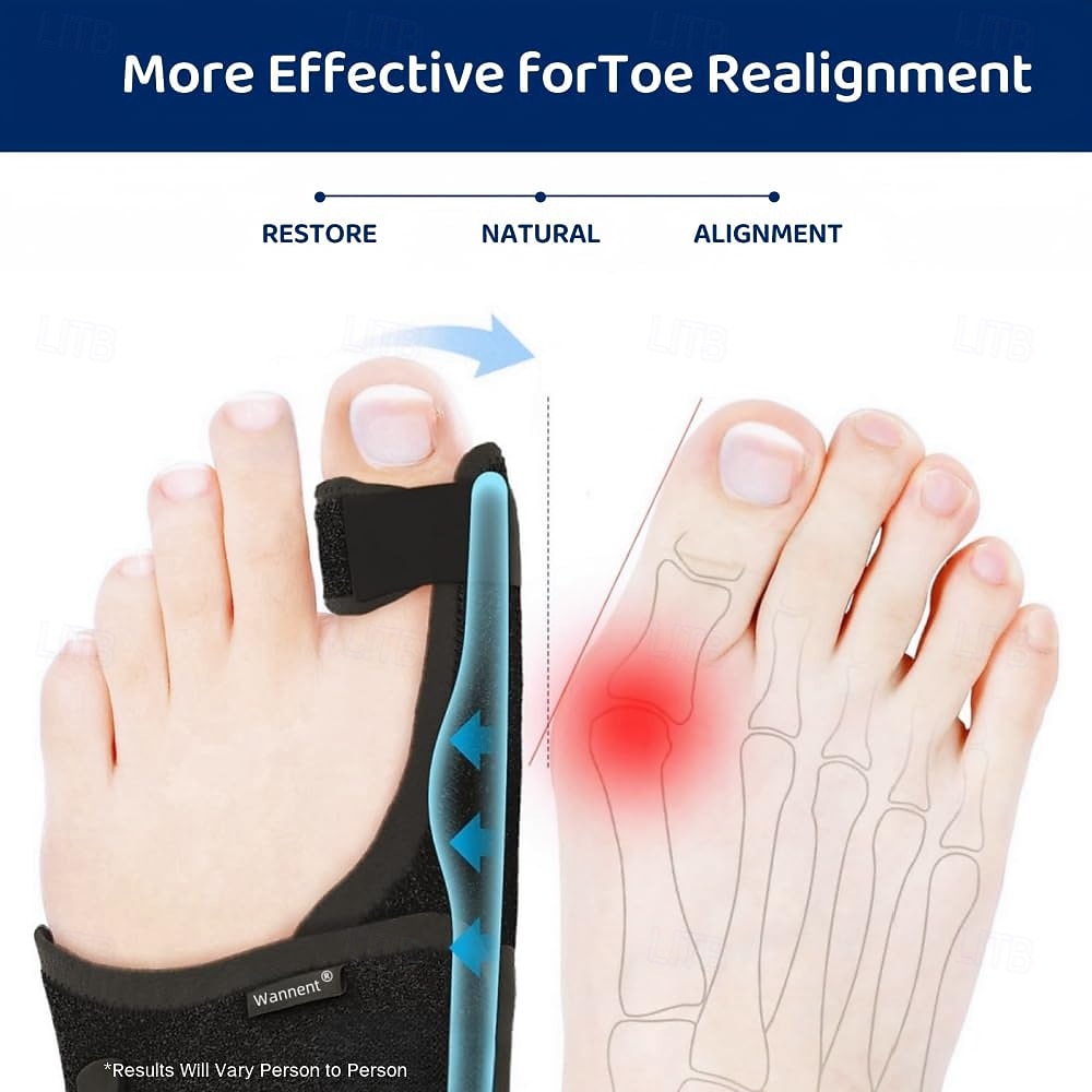 Bunion Corrector for Women Big Toe Straightener Orthopedic Bunion Splint Non Surgical Hallux Valgus Correction Hammer Toe Straightener Comfortable Breathable for Day Night 2026 - $24.99 –P2