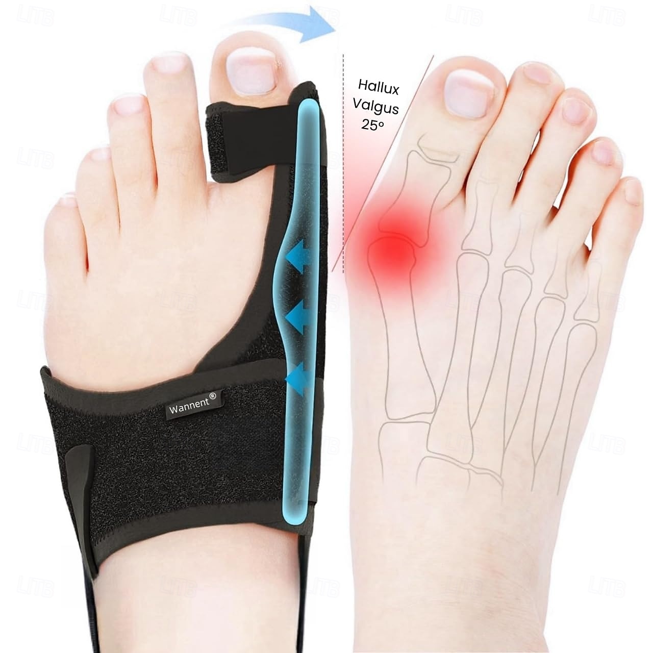 Correttore per alluce valgo per donne, raddrizzatore per alluce valgo, stecca ortopedica per alluce valgo, correzione non chirurgica dell'alluce valgo, raddrizzatore per dita a martello, comodo e del 2025 a $24.99 –P1