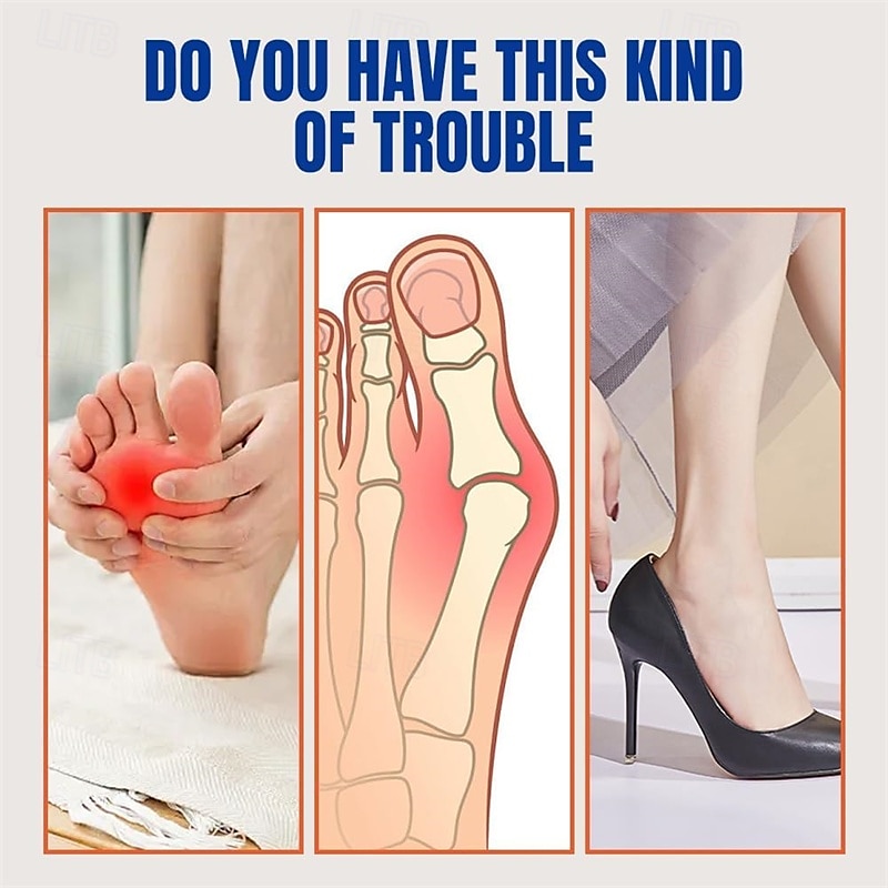 4 páry silikonových oddělovačů prstů, korektorů bunionů pro ženy a muže, prodyšné a měkké vložky do prstů pro úlevu od bolesti nohou a správné zarovnání 2026 - $15.99 –P4