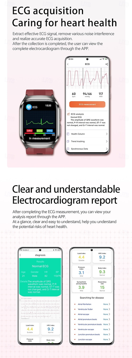 Воздушный насос Тип подушки точное измерение артериального давления ЭКГ электрокардиограмма мониторинг температуры шагомер Совместимость Bluetooth вызов с Android iOS Для женщин мужчин Долгий режим 2026 - $153.99 –P7