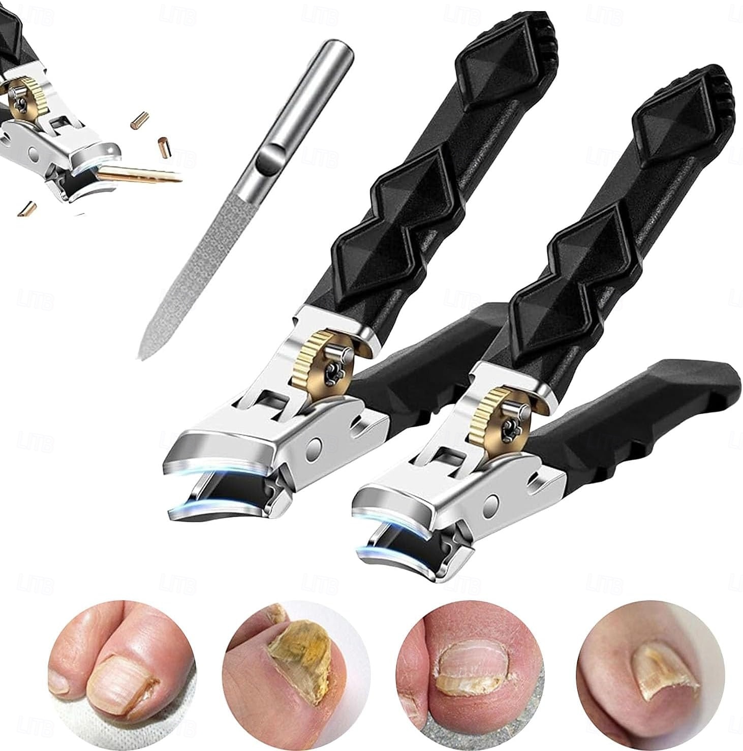Set de clești de unghii Orthoclip de calitate medicală - cu maxilar lat &clește de tuns cu vârf unghiular pentru păr gros &unghii încarnate, cu blocare de siguranță &pilă de unghii, pentru vârstnici 2025 - $24.99 –P1