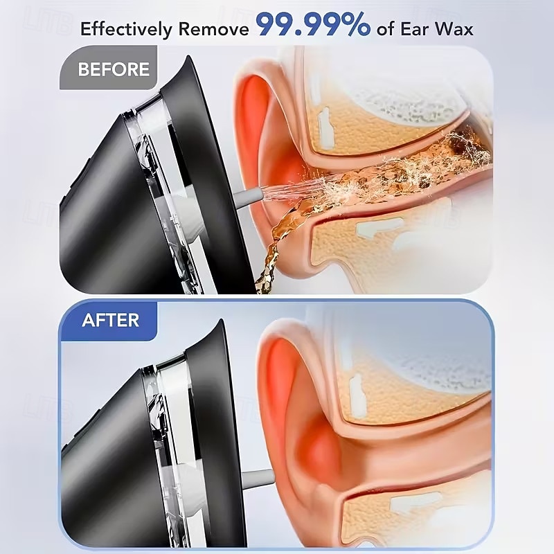 Professional-Grade Electric Earwax Removal SystemThree-Speed Hydraulic Ear Cleaning Kit with USB Charging Water Temperature Sensor and Visible Waste Bin for Home Ear Hygiene Care 2025 - $53.99 –P6