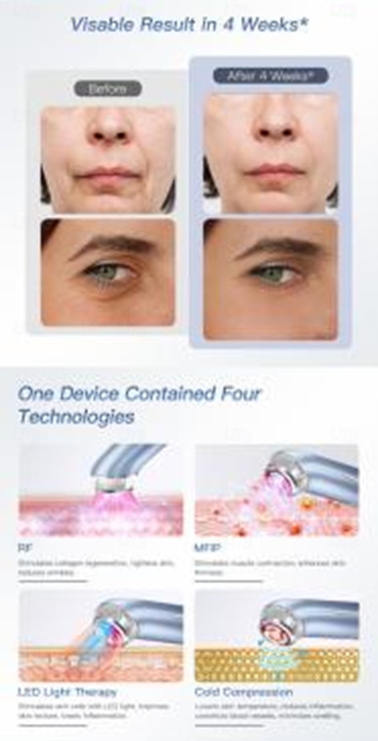 New Hot Selling EMS Micro Current RF Beauty Device Home Facial Introduction Device Multifunctional Facial Beauty Device Clear Pores Dirt Fade Wrinkles Increase Skin Elasticity Combined with RF 2026 - $102.99 –P6