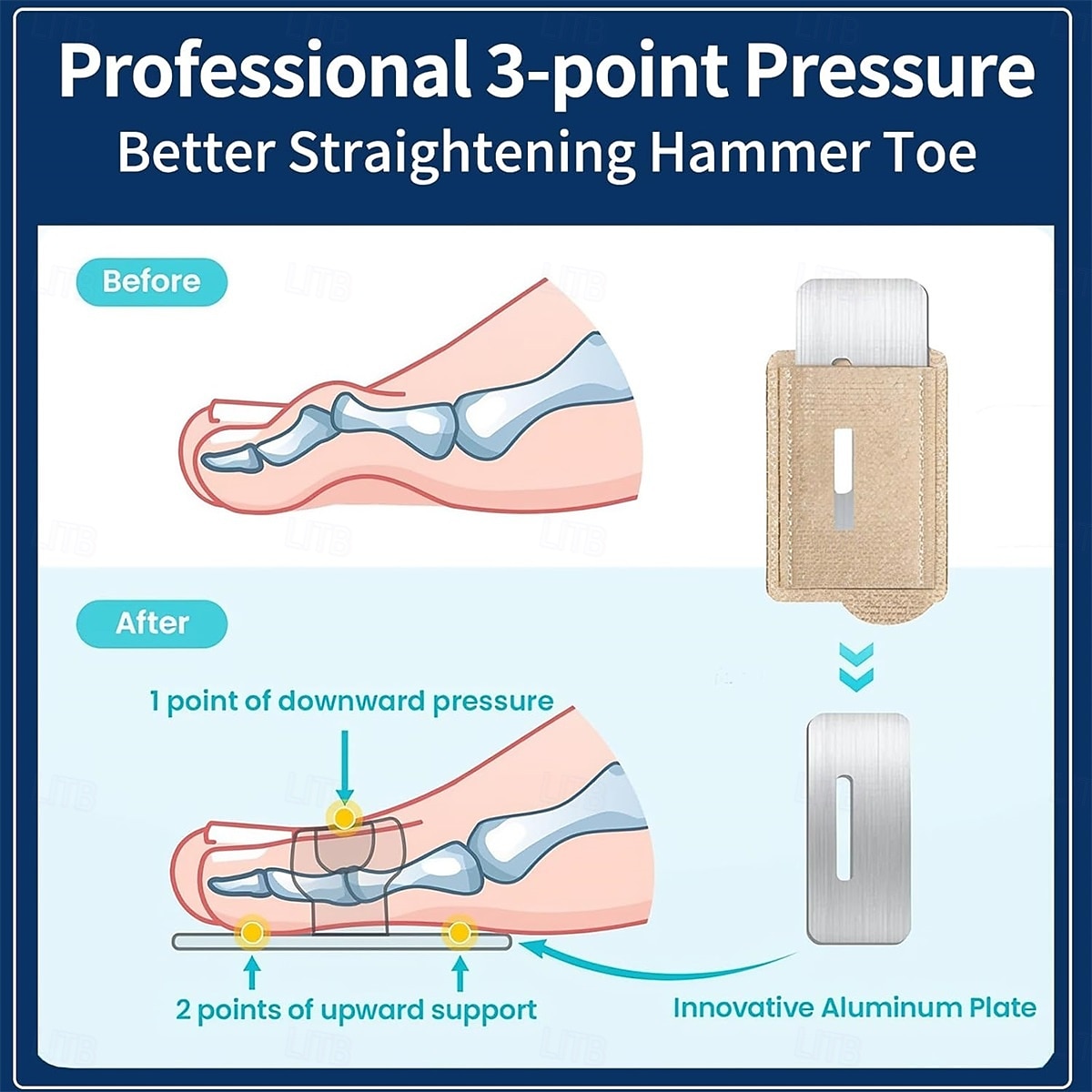 2PCS Toe Straightener, Hammer Toe Corrector for Women & Men, Toe Splint for Broken Toe, Adjustable Toe Wraps with Removable Aluminum, Toe Spacers Support Crooked Toes, Overlapping Toes, Curled Toes 2026 - $8.49 –P2