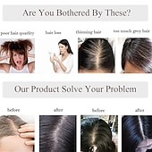 economico Pezzi di capelli umani e toupet-scelte 120% densità base di seta parrucchino superiore 100% estensioni dei capelli umani clip in su capelli topper per le donne parte superiore dei capelli fatta a mano parte centrale con perdita di