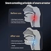 cheap Personal Protection-1pc Intelligent Anti Snoring Device For Adults Magic Device For Preventing Snoring Home Snoring Respirator For Male Snorers 6-step Adjustment Of Anti Snoring Drugs For Male Snorers