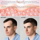 olcso Arcápoló készülékek-2023 legújabb, 540 tűs ems derma roller mikroáramú mikrotűző henger piros kék fényterápiával és vibrációs bio hengerrel g5