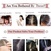 cheap Human Hair Pieces &amp; Toupees-6 Inch 100% Remy Human Hair Silk Base Top Hairpiece for Women Clip in Topper Hand-made Top Toppee Hair piece 120% Density Middle Part with Thinning Hair #4P27 Medium Brown&amp;Dark Blonde 27g