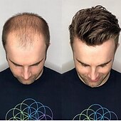 voordelige Stukken en toupetjes van echt haar-haarstukken en pruiken menselijk haar mannen toupet mono kant met npu rond kantsystemen maat 7x9 inch 6&#039;&#039;lengte 1b 6x8 7x9 8x10