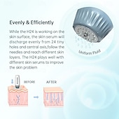 levne Nástroje pro péči o pleť-h24 derma razítko nastavitelné 0,25 mm-1,5 mm mikrojehličkový aplikátor tekutého séra pro zlepšení pleti na jizvy po akné