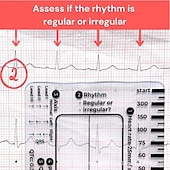 cheap Event &amp; Party Supplies-ECG 7 Step Ruler, ECG Ruler Plastic Ruler Measuring Tool, ECG 7 Step Ruler for ECG/EKG Interpretation, Transparent EKG Calipers Measuring Tool, Follow a 7 Step Plan