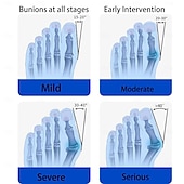 cheap Braces &amp; Supports-Bunion Corrector for Women Men Big Toe,Adjustable Knob Bunion Corrector for Bunion Relief,Bunion Fix with Bunion Silicone Pad,Suitable for Left and Right Feet