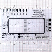 cheap Event &amp; Party Supplies-ECG 7 Step Ruler, ECG Ruler Plastic Ruler Measuring Tool, ECG 7 Step Ruler for ECG/EKG Interpretation, Transparent EKG Calipers Measuring Tool, Follow a 7 Step Plan