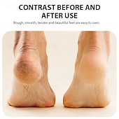 cheap Facial Care Device-Rechargeable Electric Foot Grinder Dead Skin Remover Calluses Feet Scrubber Electric Foot File Dry Dead Cracked Foot Care Repair