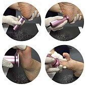 お買い得  パーソナルケアと健康-電動フットケアペディキュアフットファイル角質除去角質除去フットスクラバープロ仕様のフットケアマシンで柔らかく滑らかな足を実現、家庭用ペディキュアツール