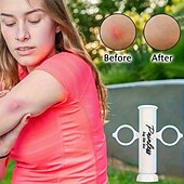 お買い得  キャンプ用品-真空毒抽出器 1個、蚊や蜂の刺されの吸引ツール、アウトドアサバイバル緊急キット、ヘビに噛まれた時の毒抽出ポンプ