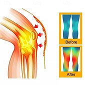 رخيصةأون الرعاية الشخصية والصحة-زوج واحد من أكمام الركبة ذاتية التسخين بالضغط على نقاط معينة من التورمالين، وسادات ركبة حرارية مزدوجة الجوانب من نبات الشيح للرجال &amp;دعامة دعم المفاصل الدافئة للنساء لعلاج برودة الساقين وتخفيف آلام