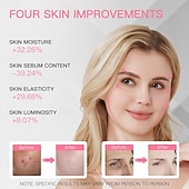 halpa Kasvojen hoitolaitteet-uusi tuote led-punainen valo kauneus kasvonaamio fda-sertifioitu kotitalouksien silikoninen kasvonaamio valohoito kasvojen kauneuslaite led-valoa emittoiva kasvonaamio kaulahihnalla usb-lataus 2500 ma