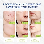 billiga Ansiktsbehandling-ny het säljande led silikon skönhetslampa skönhetsinstrument helkropps röd och blå fotonföryngringsspektrometer minskar rynkor ökar hudens elasticitet eliminerar envist fett optimerar co